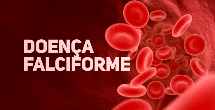 banner doencafalciforme 736x378